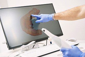Digital dental impression on computer monitor