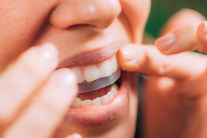 Woman placing whitening strip on her teeth
