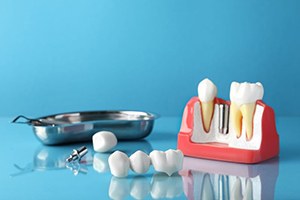Dental implant, abutment, and restoration on reflective surface