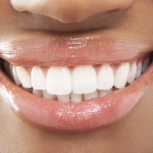 Close-up of woman’s perfect teeth after cosmetic bonding in Needham