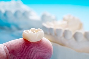 Dental crown resting on person’s fingertip