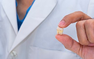 Dentist holding extracted tooth between thumb and forefinger