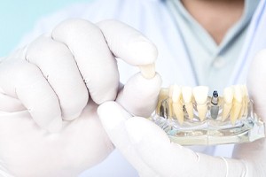 Close-up of gloved hands holding dental implant model