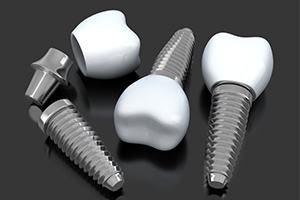 Three animated dental implant supported replacement teeth