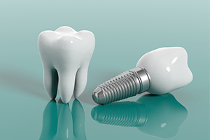 Animated tooth and dental implant supported replacement tooth