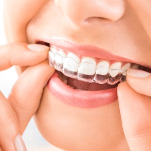 Close-up of woman’s mouth as she uses Invisalign® in Needham