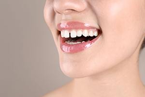 Woman’s smile with gap between the front teeth