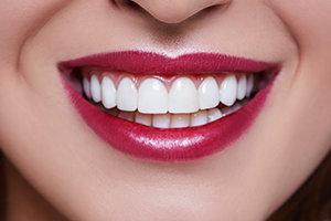 Closeup of healthy smile after periodontal therapy