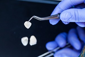 Gloved hand using tweezers to pick up dental veneer