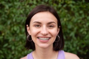 Woman smiling after addressing swollen gums with braces