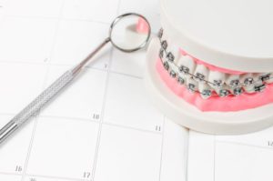 Dental model with braces on top of calendar