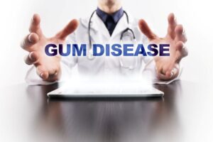 &ldquo;Gum Disease&rdquo; wording between hands of medical professional 